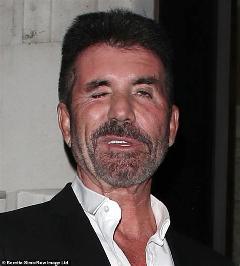 Simon Cowell Continues To Show Radically Different Features During Date