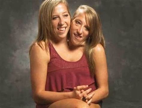 Abigail i Brittany Hensel najsłynniejsze bliźniaczki syjamskie