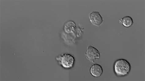 World First Footage Of White Blood Cells Demise Recorded In Melbourne