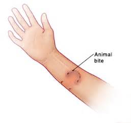 Animal Bite (General)