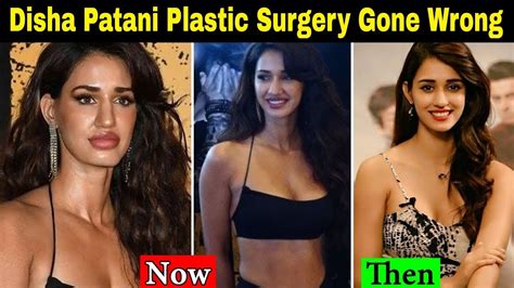 disha patani s shocking plastic surgery look disha patani plastic surgery gone wrong youtube