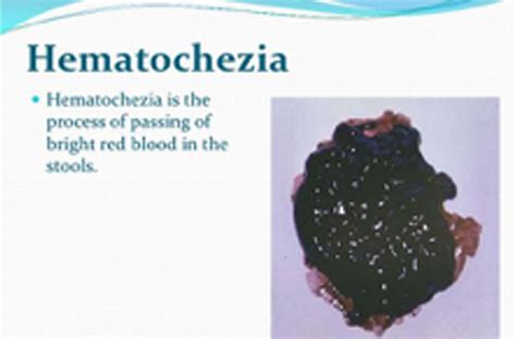 Hematochezia