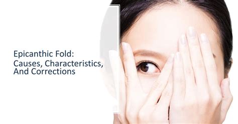 Epicanthic Fold Causes Characteristics And Corrections Dream Plastic Surgery