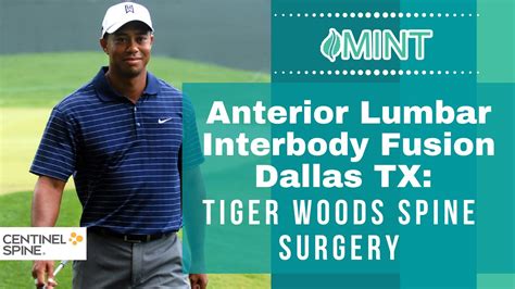 Anterior Lumbar Interbody Fusion Dallas Tx Tiger Woods Spine Surgery