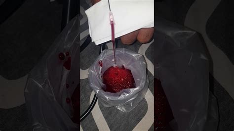 Misalnya, gangguan pada fungsi pengatur indra perasa, akibat saraf mengalami tekanan, misalnya mengetik. Hasil darah fasdhu tangan kebas dan asam urat#081383369012 ...