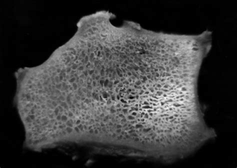 Trabecular Bone Xray