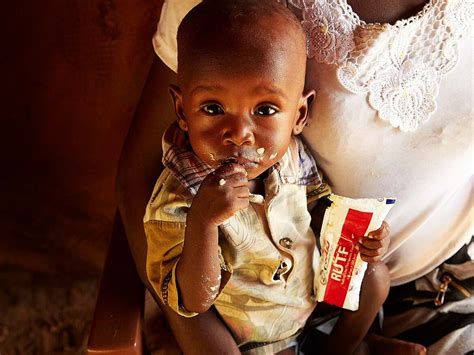 Alle 13 Sekunden Stirbt Ein Kind An Hunger Unicef Österreich