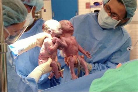 Parents Of Twins Born Holding Hands Describe Experience My Heart Just