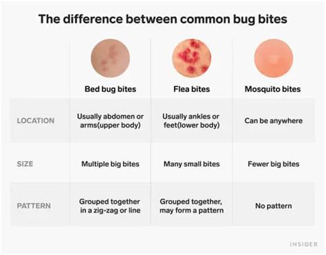 Difference Between Flea Bites And Mosquito Bites Differences Finder