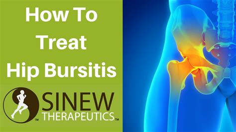 How To Treat Hip Bursitis And Speed Recovery Youtube