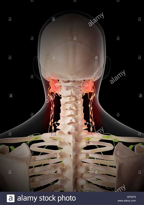 Painful Human Lymph Nodes Illustration Stock Photo Alamy
