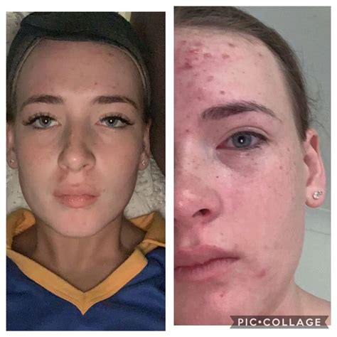 Humans are not capable of making it internally (most other animals can manufacture it in their livers). Before and after using JSHealth Skin + Digestion Vitamins ...