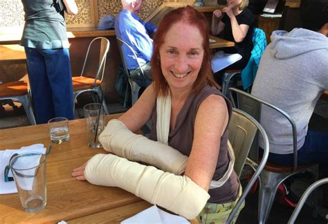 What I Learned When My Wife Broke Both Her Wrists Psyched In San