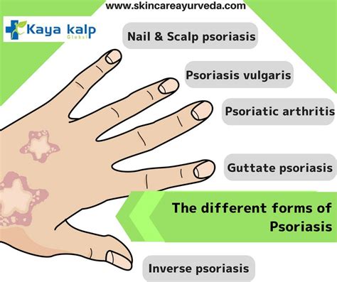 Kayakalp Global Ayurvedic Psoriasis Treatment By Kayakalp Global