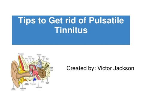 Treatment For Pulsatile Tinnitus Tinnitus Can It Be Cured Causes For