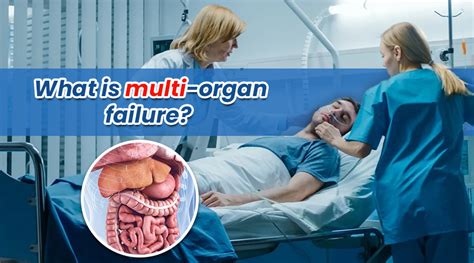What Is Multi Organ Failure What Causes It Can It Be Reversed