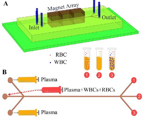 Magnetophoretic Separation Of Wbcs And Rbcs Within Blood Plasma A