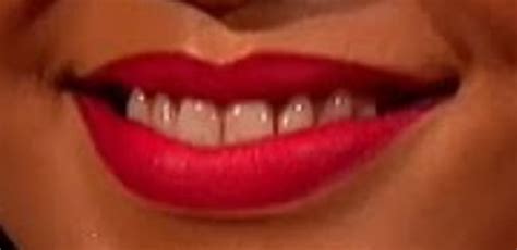 Rihanna Teeth Pictures
