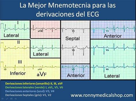 Derivaciones Y Anatomía Del Corazón Ekg Ecg Cardiología Enfermería