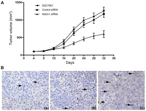 Combined Effect Of Notch Sirna And Doxorubicin On Tumor Growth