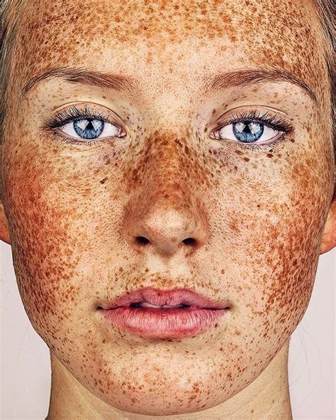 Best Freckles Birthmark Beauty Mark Speckle Sommersprossen