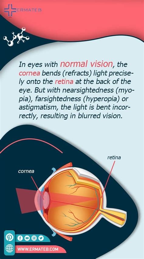 Normal Vision 👁️ Lasik Eye Surgery Astigmatism Eye Surgery