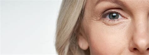 Wrinkles And Fine Lines Fresno Behr Laser And Skin Care Center