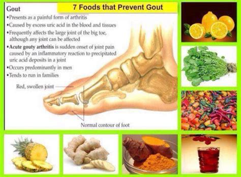 7 Foods That Prevent Gout Musely