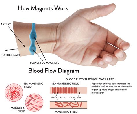 How Magnetic Therapy Works And How It May Help You Magnet Therapy