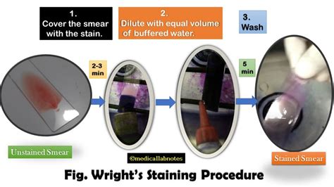 Wright Stain Introduction Principle Preparation Procedure Result
