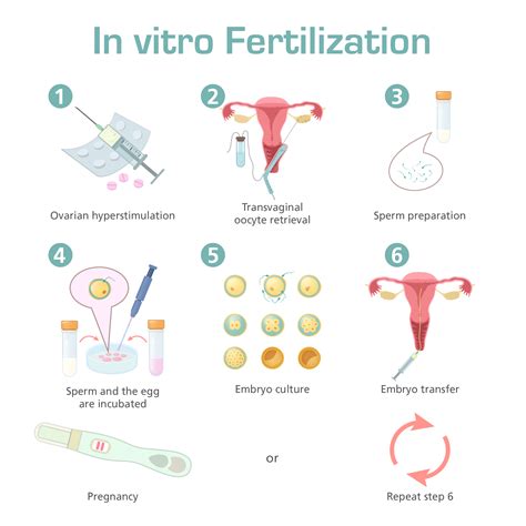 Esco Medical In Vitro Fertilization IVF As Fertility Treatment
