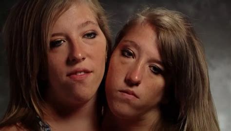 Conjoined Twins Abby And Brittany Reveal Astonishing News Years Later