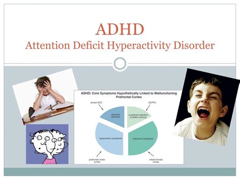 Ppt Adhd Attention Deficit Hyperactivity Disorder Powerpoint Presentation Id