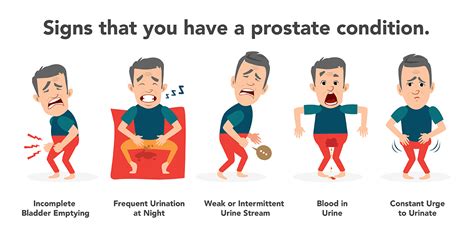 Prostate Cancer Types Causes Symptoms Diagnosis Treatment Sexiz Pix