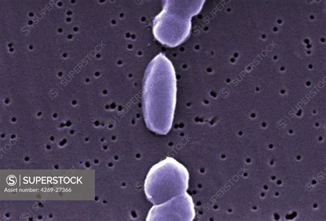 Vibrio Parahaemolyticus Scanning Electron Micrograph Sem Of Vibrio