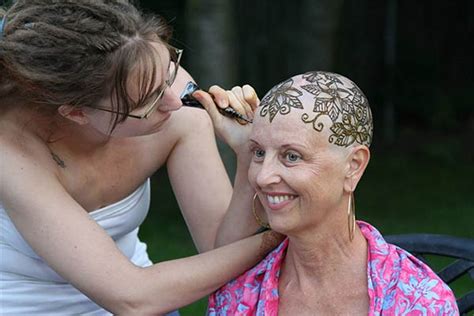 Beautiful Henna Crowns For Patients Dealing With Hair Loss
