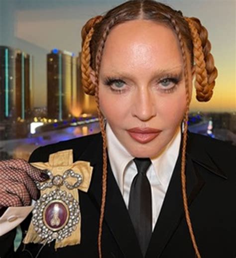 Madonna Col Viso Deformato Ai Grammy 2023 I Messaggi Dei Fan