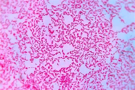 Bacterias Gram Negativas Caracter Sticas Estructura Enfermedades