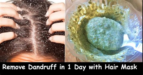 Best Homemade Hair Masks To Remove Dandruff Home Remedies