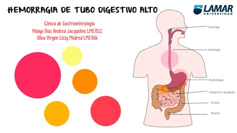 Hemorragia de tubo digestivo alto by Andrea Jacqueline Pelayo Díaz