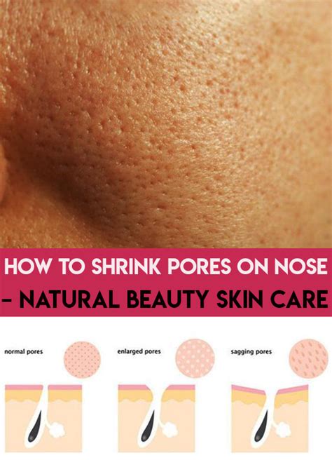 How To Shrink Pores On Nose Natural Beauty Skin Care Nose Pores