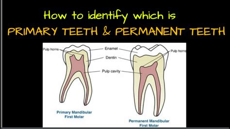 Difference Between Primary And Permanent Tooth Youtube