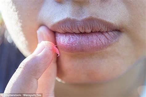Luk Beautifood Founder Cindy Luken Reveals The Cure For Chapped Lips