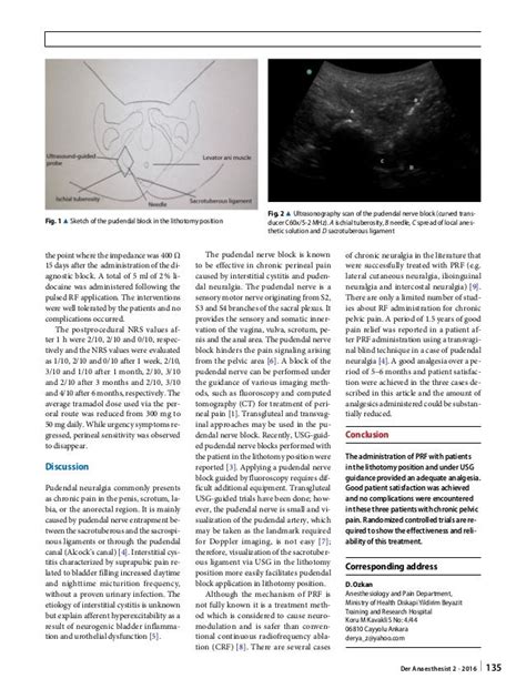 Ultrasound Guided Pulsed Radiofrequency Treatment Of The Pudendal Ner