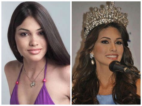 Before And After Miss Venezuelas Transformation