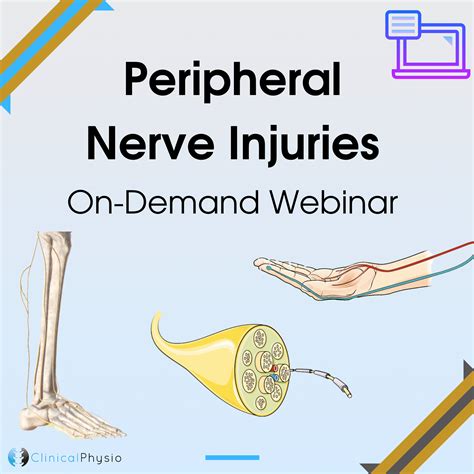 Peripheral Nerve Injuries On Demand Webinar Clinical Physio