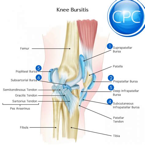 Bursitis Knee Pain Carolinas Pain Center Pain Relief Options