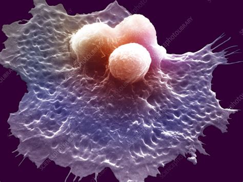 Macrophage Engulfing Cancer Cells Sem Stock Image C0052030