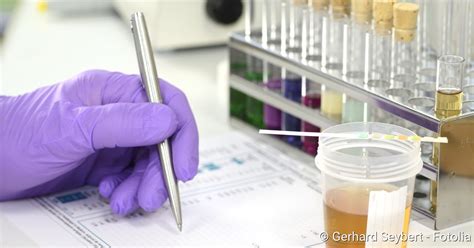 Dieser akuteverschluss eines darmgefäßes trifft meist menschen über 60 jahre, bei denen bereits ähnliche gefäßverengungen von anderen körperregionen bekannt sind. Blut im Urin: Ursachen, Urinfarbe, Wann sollten Sie zum ...