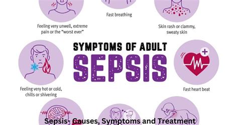 Sepsis Causes Symptoms And Treatment